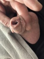 Small gape