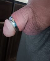Glans Ring