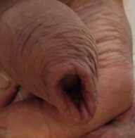 For the lovers of my foreskin